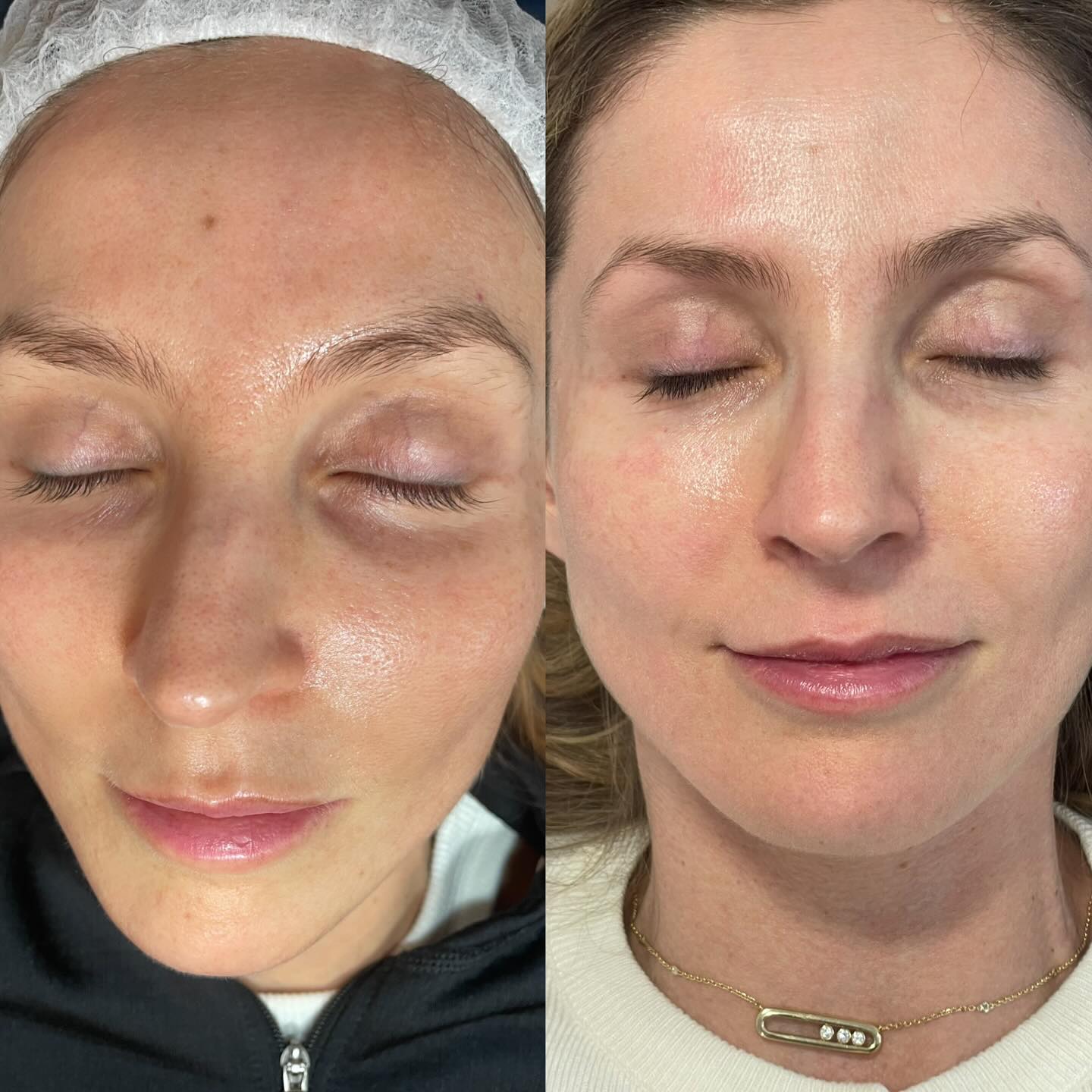 skin treatment Georgetown tx
